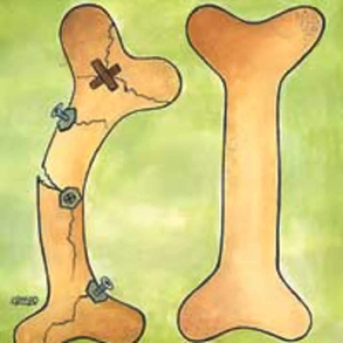 راه‌های داشتن استخوان‌های قوی‌تر از دوره کودکی