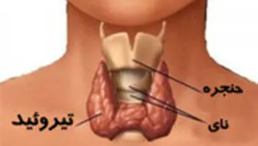 ارتباط بیماری تیروئید با ناباروری