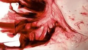 ۷ علت خونریزی شدید قاعدگی