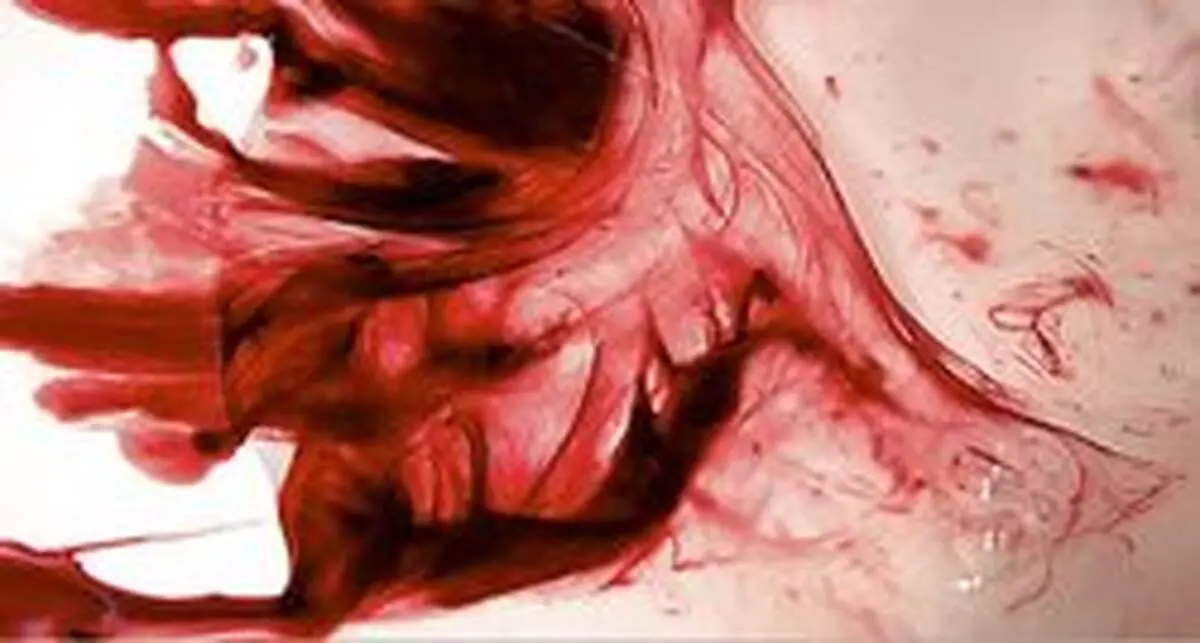 ۷ علت خونریزی شدید قاعدگی