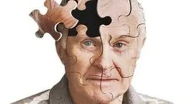 طراحی بزرگترین نقشه مغزی از بیماری آلزایمر