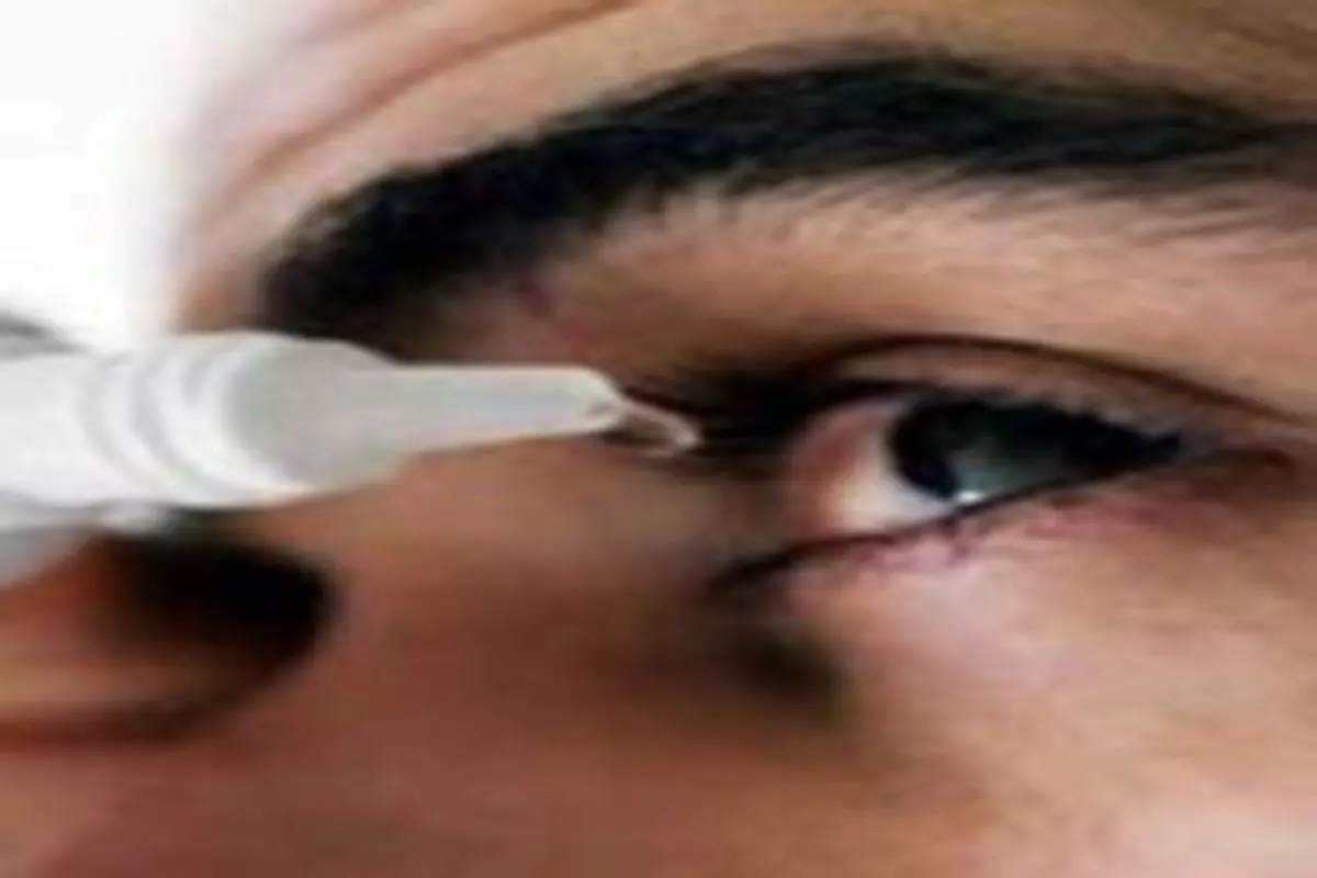 علت خشکی چشم چیست