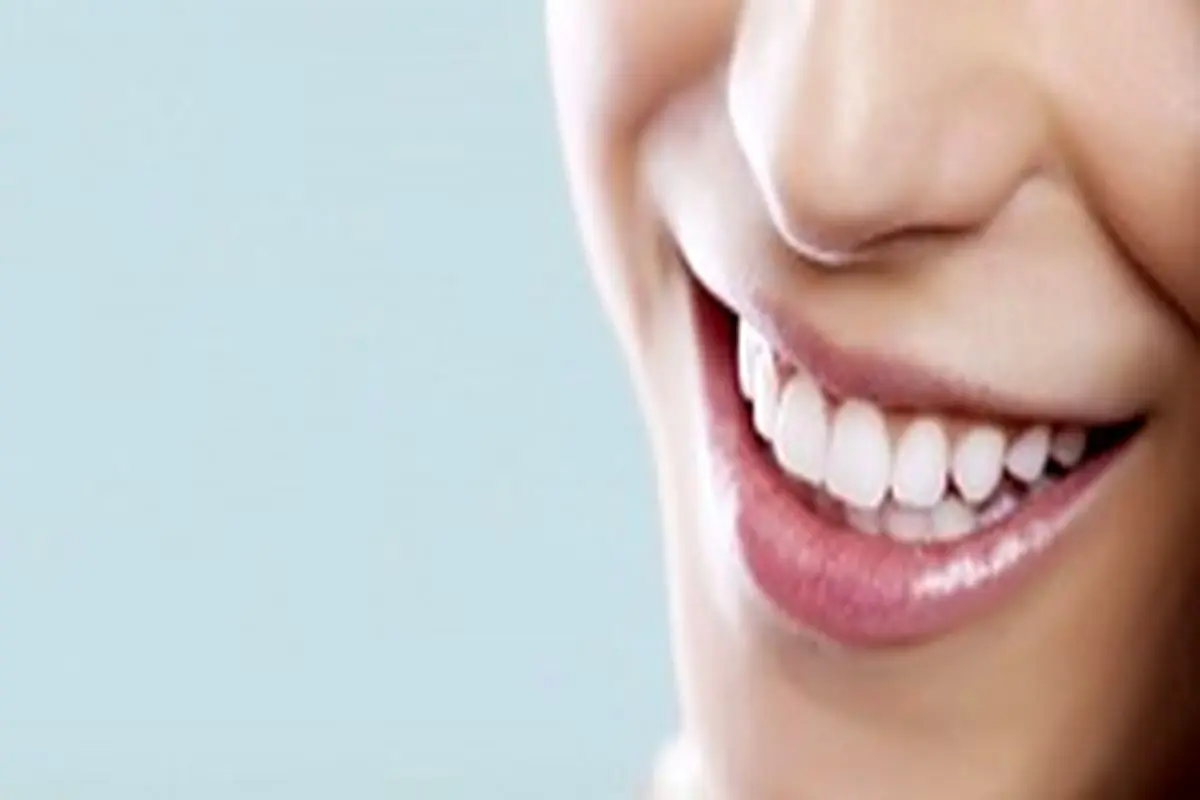 سوالات رایج در مورد سفید کردن دندان ها به صورت طبیعی