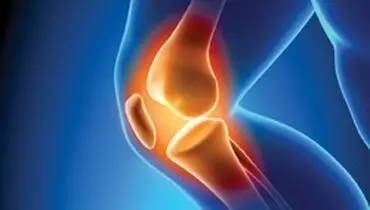 دلایل مختلف درد زانو