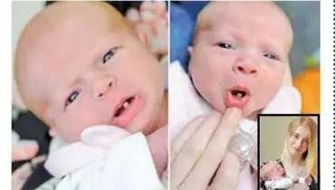 نوزادی که با یک دندان متولد شد + عکس