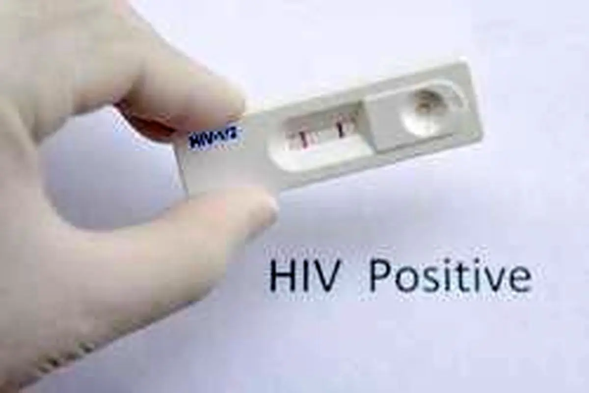چه زمانی آزمایش ایدز لازم است؟
