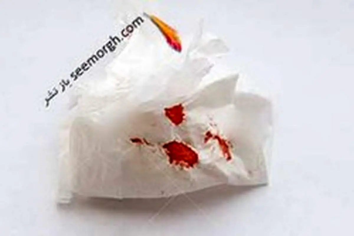 علت و پپیشگیری از خونریزی در رابطه مقعدی