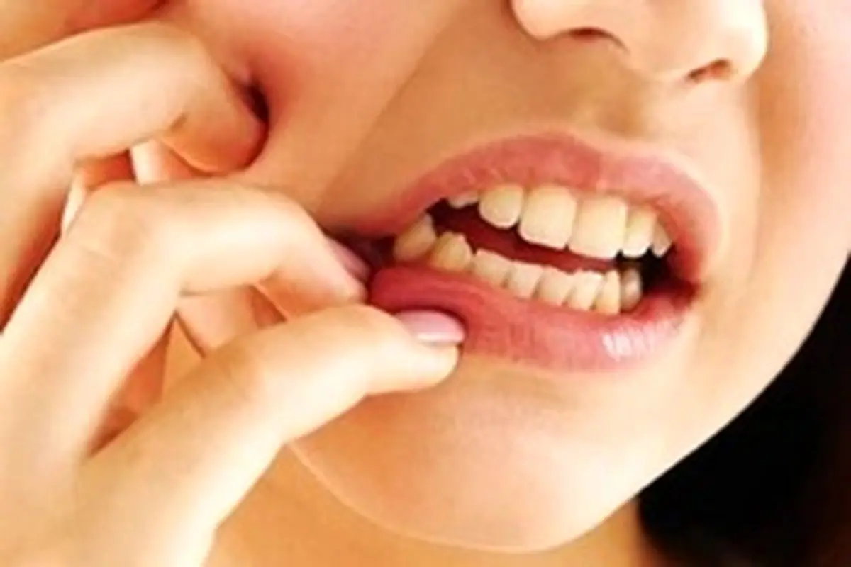  چه عواملی باعث بروز توده یا تومور در دهان می شوند؟