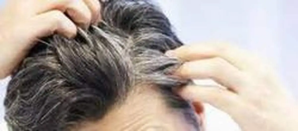 ۵ ماده غذایی که جلوی سفید شدن موی شما را می‌گیرد