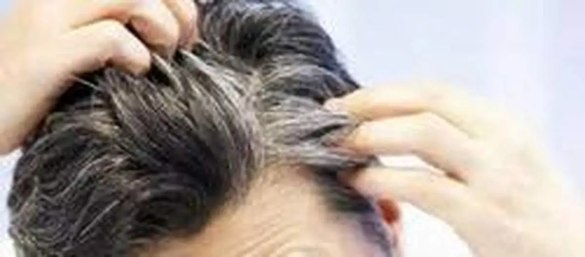 ۵ ماده غذایی که جلوی سفید شدن موی شما را می‌گیرد