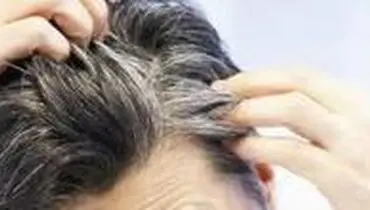 ۵ ماده غذایی که جلوی سفید شدن موی شما را می‌گیرد