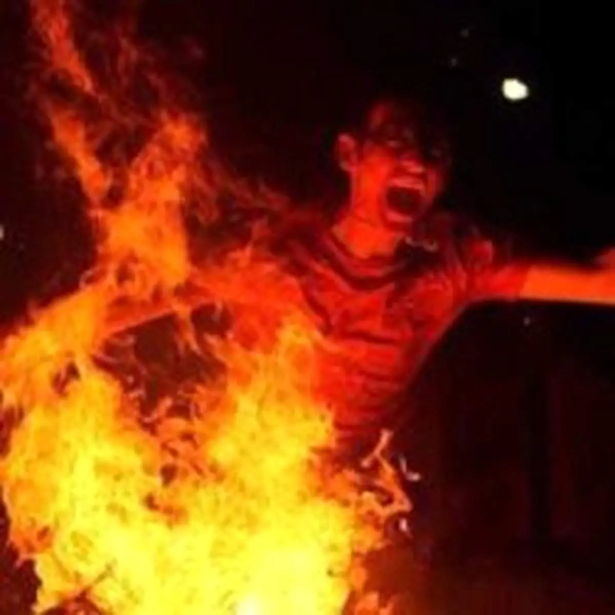 عواقب سوختگیهای چهارشنبهسوری و چند هشدار