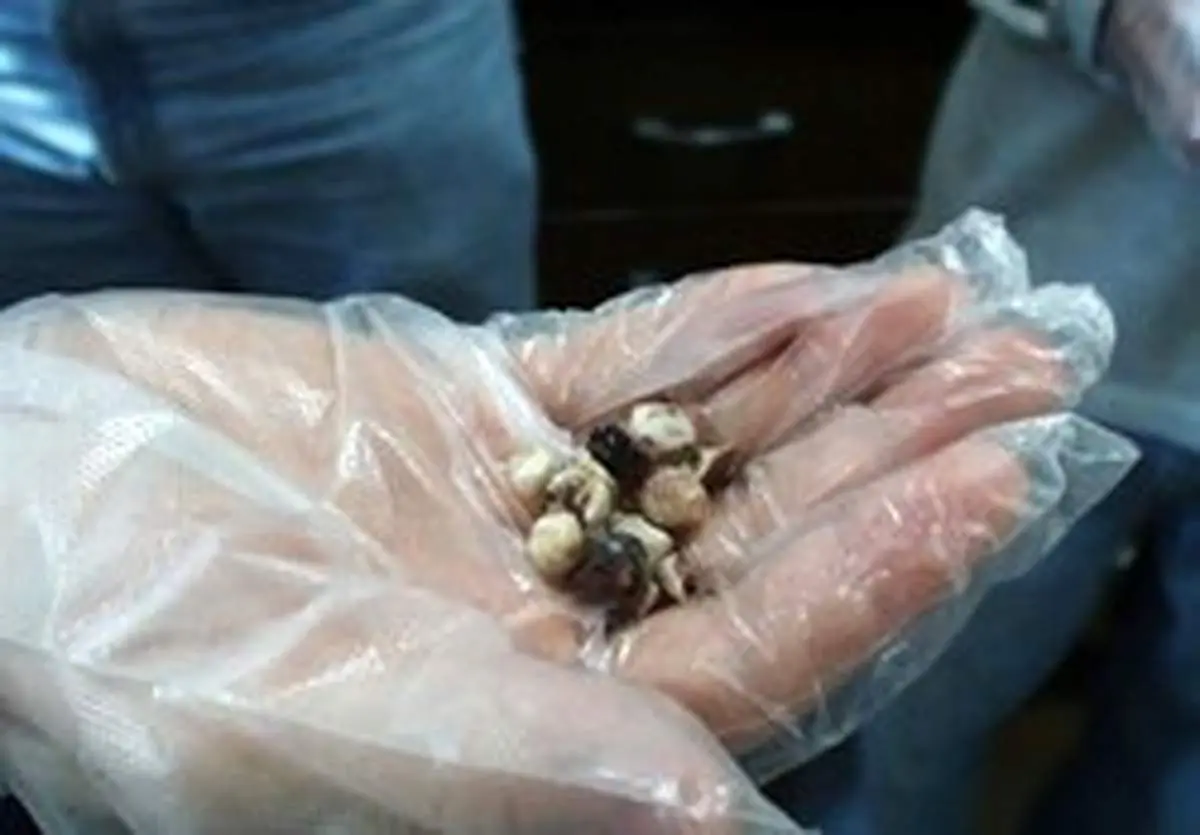 نسخه طب سنتی برای درمان سنگ کیسه صفرا