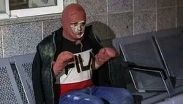 ۲۲ نفر قطع عضو شدند