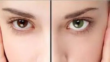 کدام خوراکی‌ها رنگ چشمانتان را عوض می‌کند؟