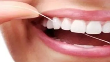چگونه از پوسیدگی دندان‌ها پیشگیری کنیم؟
