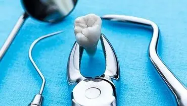 علت رشد دندان عقل چیست؟