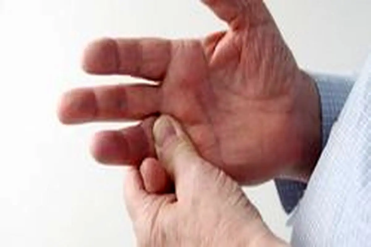 علل مورمور انگشتان را بشناسید