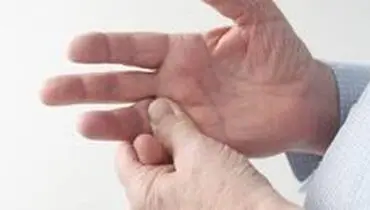 علل مورمور انگشتان را بشناسید