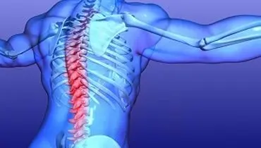 هر آنچه باید در مورد تنگی مجرای نخاع بدانید