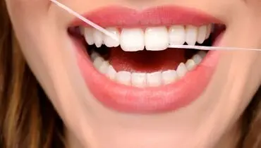 نسخه طب سنتی برای جرم گیری دندان در خانه