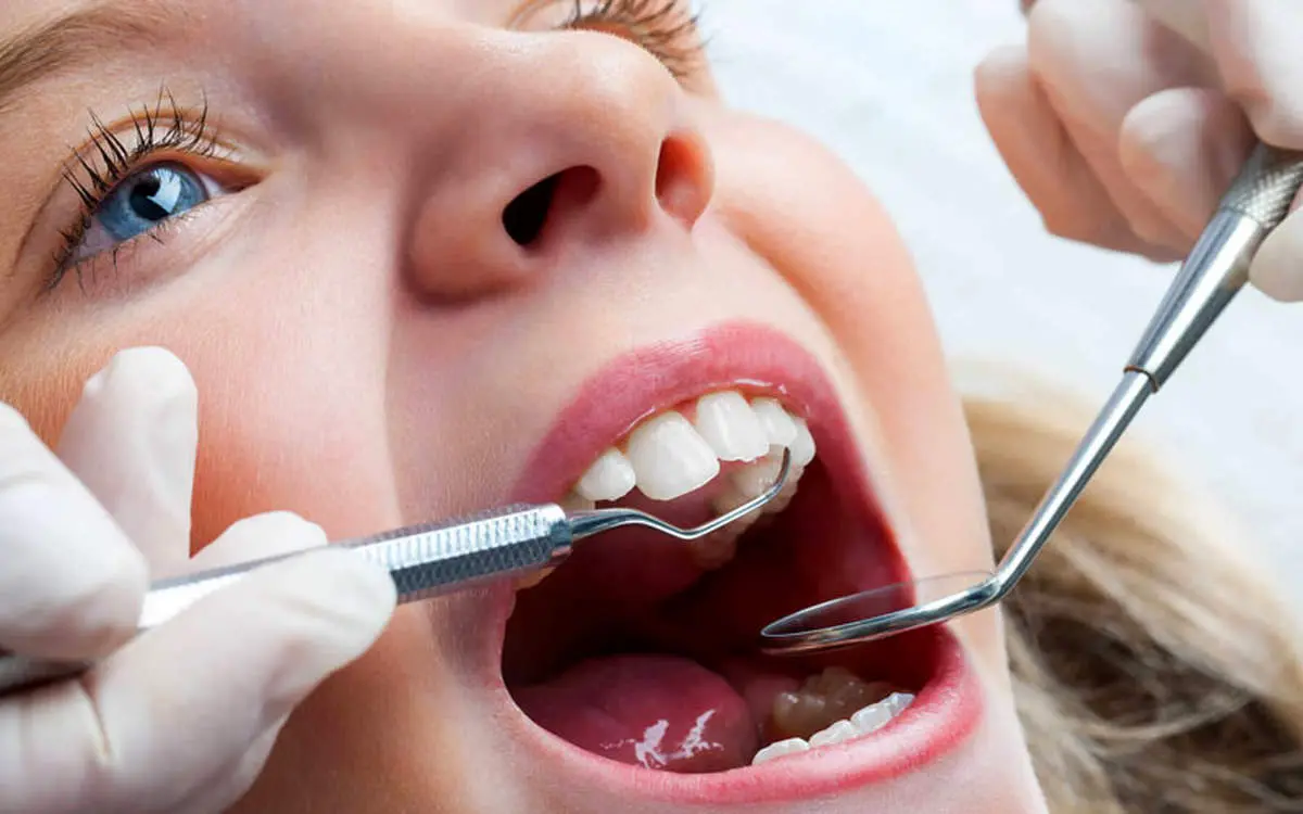 چطور از دندان‌های کودک‌مان محافظت کنیم؟