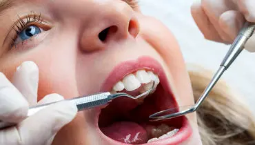 چطور از دندان‌های کودک‌مان محافظت کنیم؟