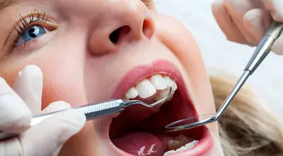 چطور از دندان‌های کودک‌مان محافظت کنیم؟