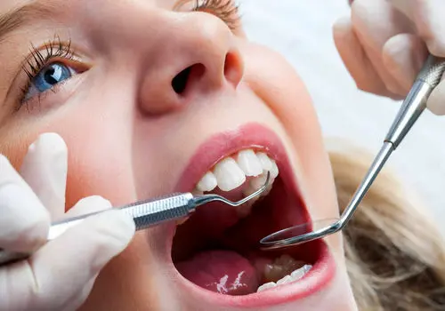 چطور از دندان‌های کودک‌مان محافظت کنیم؟