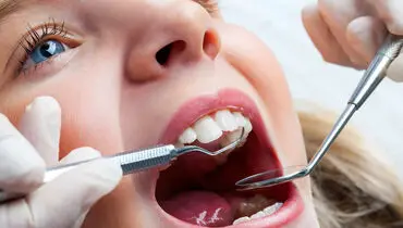 چطور از دندان‌های کودک‌مان محافظت کنیم؟