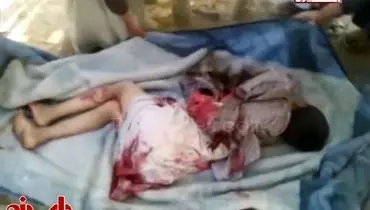 عکس: مرگ 2 کودک یمنی بر اثر حملات ارتش سعودی
