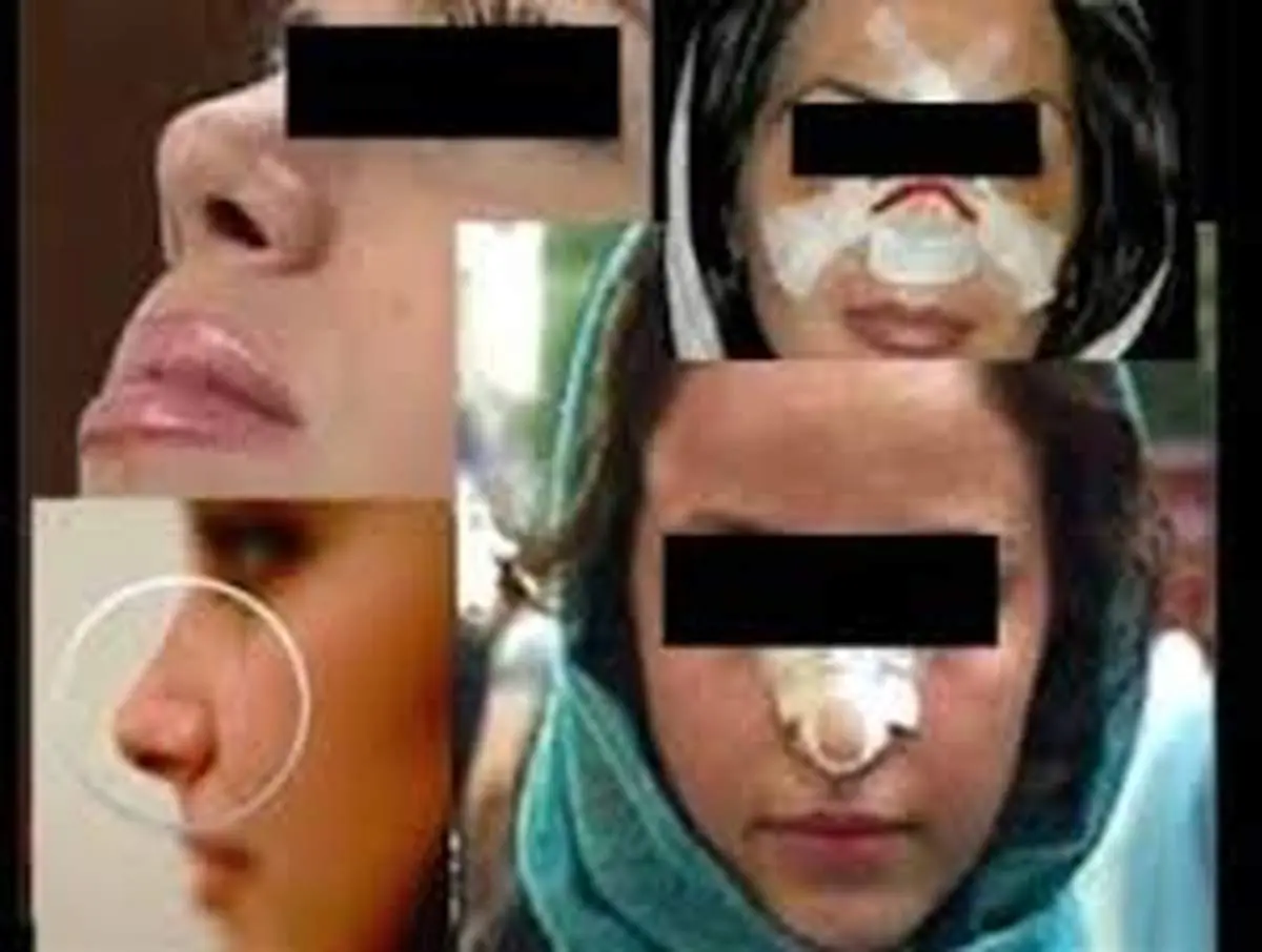 مرا به شکل اولم برگردان!