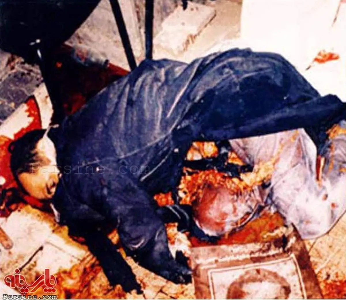 عکس:شهید هاشمی نژاد بعد از ترور/ +18