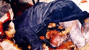 عکس:شهید هاشمی نژاد بعد از ترور/ +18