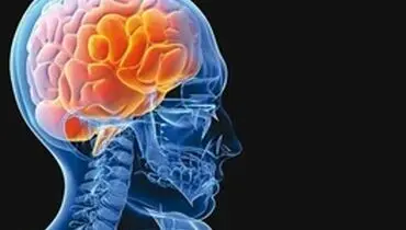 این سکته، قابل درمان ترین بیماری بشر است!