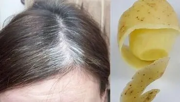 برای معالجه سفیدی مو این نسخه گیاهی را بخوانید