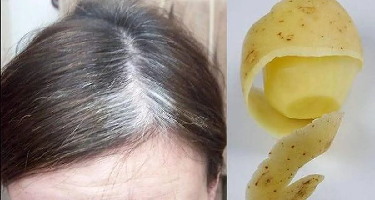 برای معالجه سفیدی مو این نسخه گیاهی را بخوانید