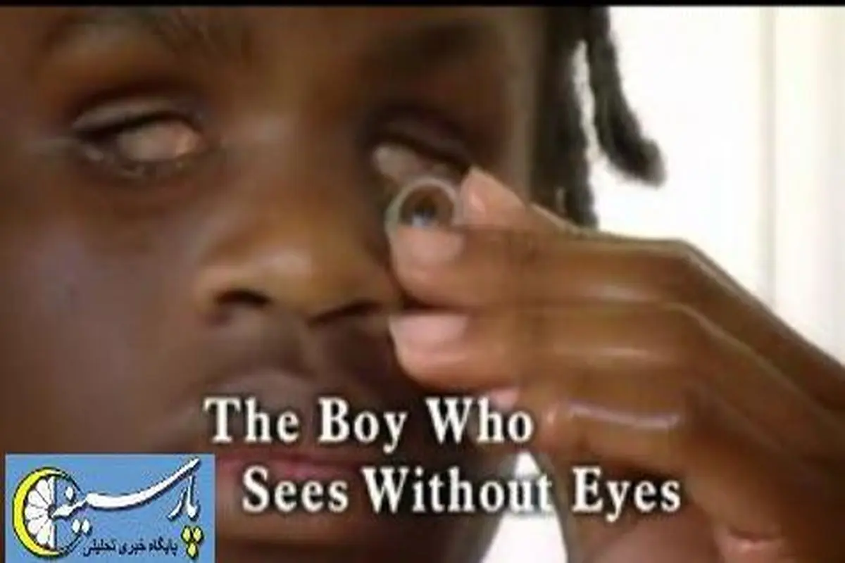 عکس : پسری که بدون چشم می بیند!