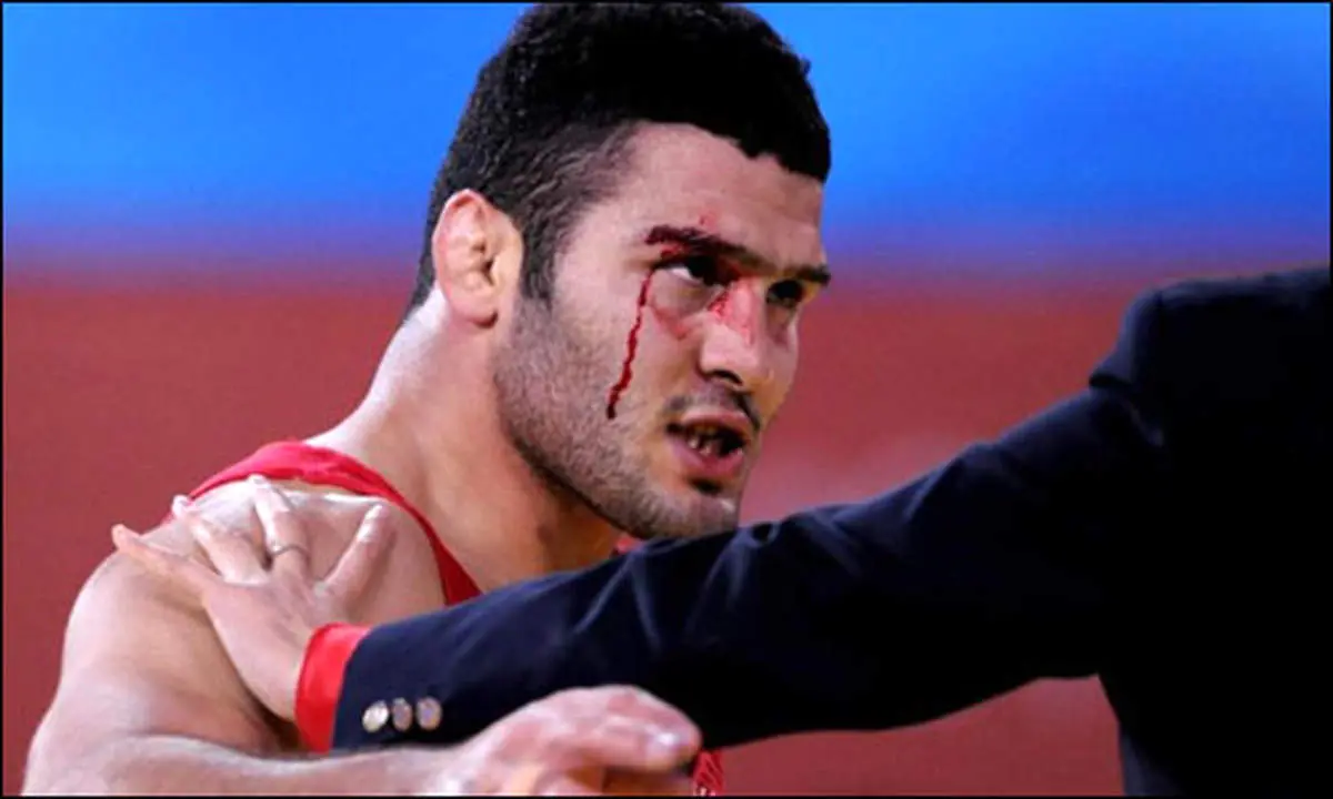 سوال روز | یزدانی المپیکی میشود یا خیر؟