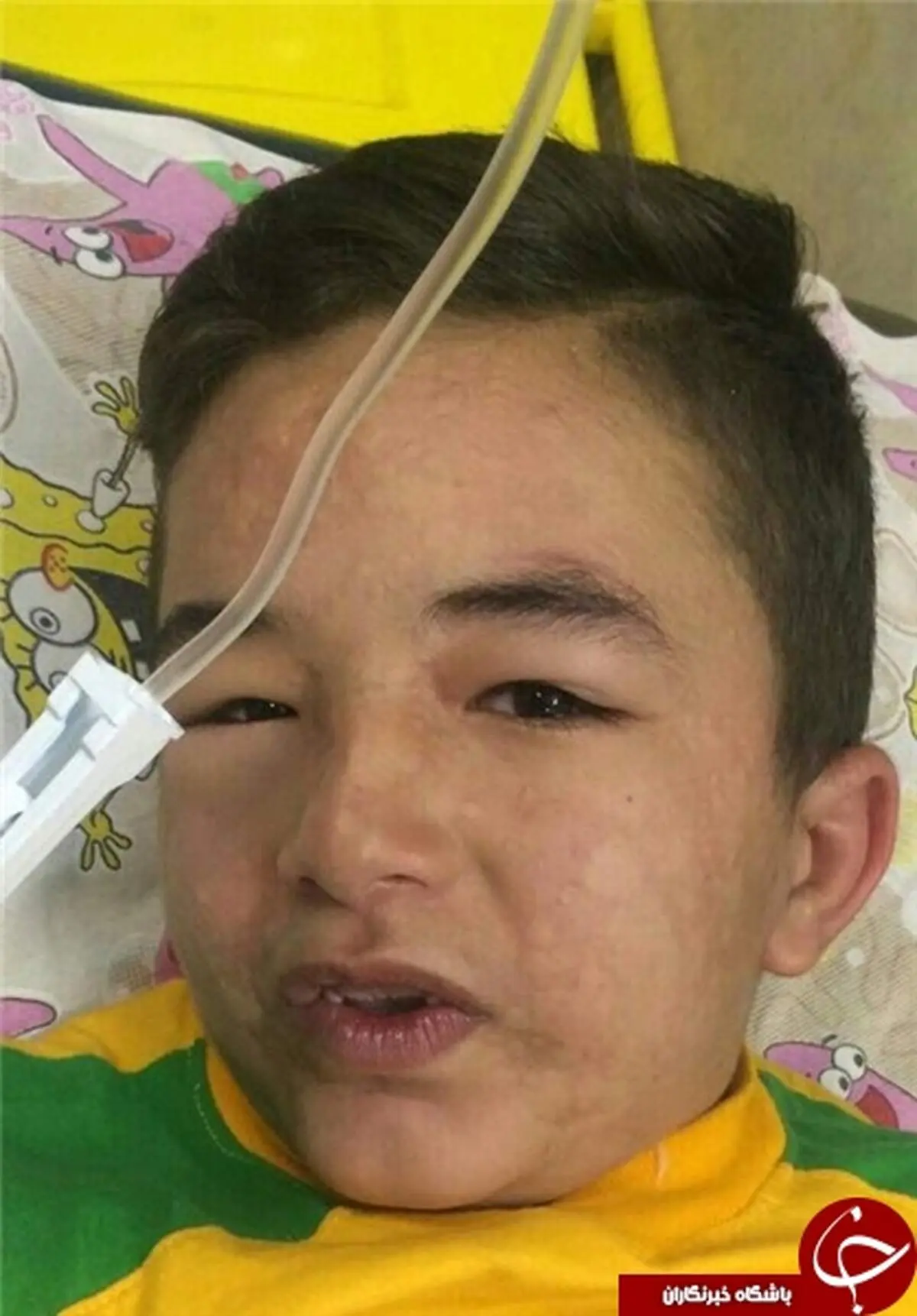 شوک کودک ۸ ساله پس از تزریق پنی‌سیلین