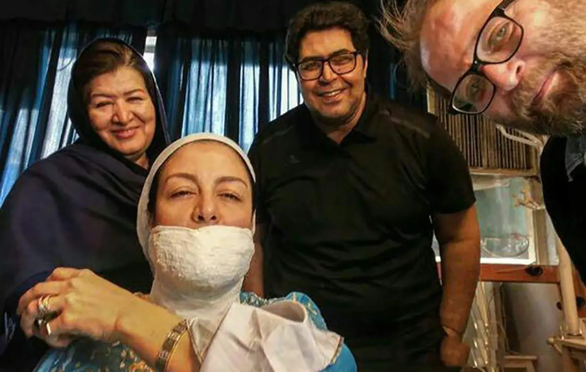 مریلا زارعی با صورت گچ گرفته