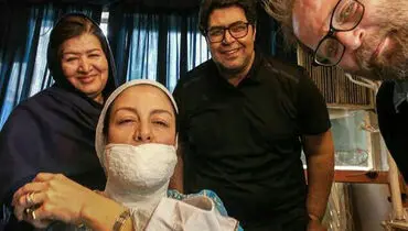 مریلا زارعی با صورت گچ گرفته