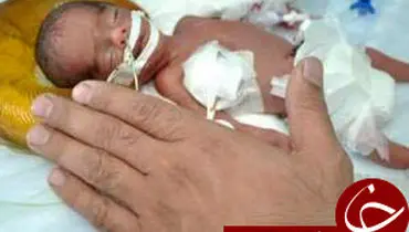 تولد نوزادی به اندازه کف دست/ عکس