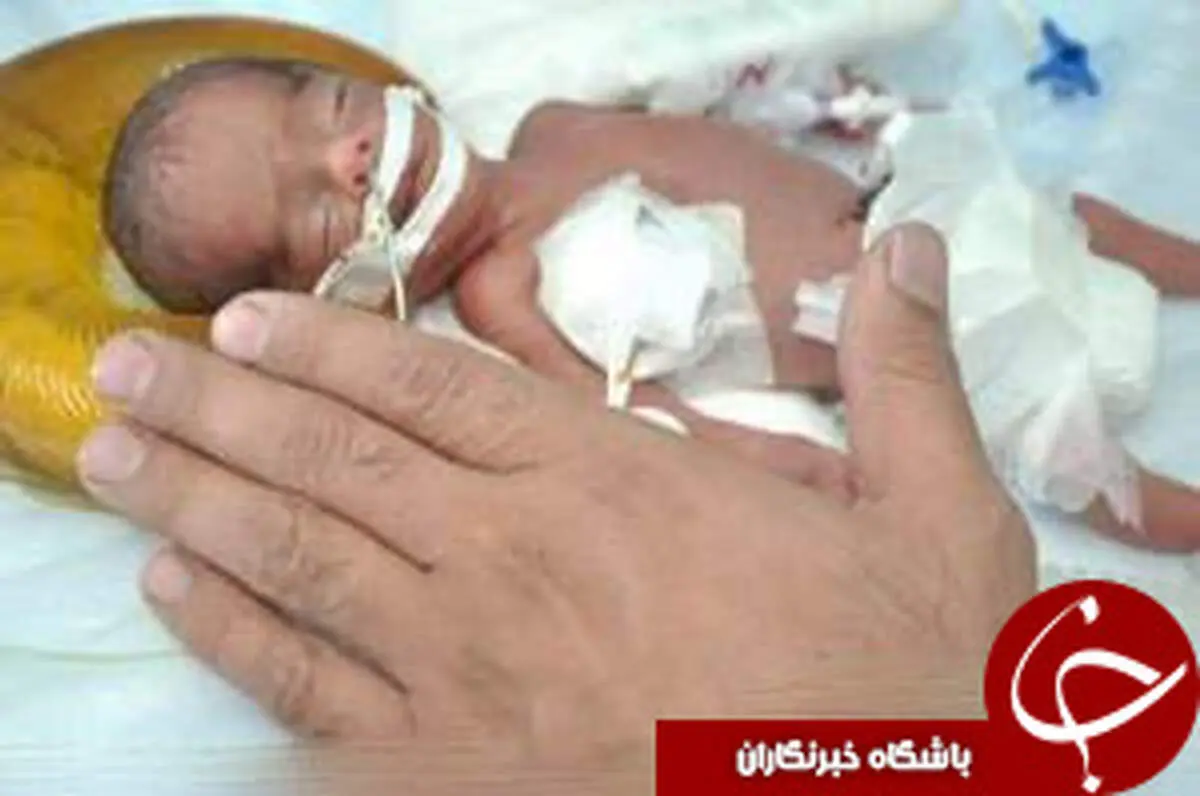 تولد نوزادی به اندازه کف دست/ عکس