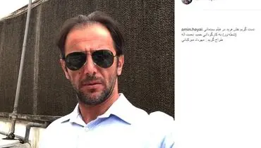 عکس | امین حیایی با چهره‌ای کاملا متفاوت