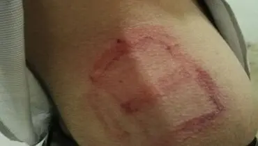 ضرب و شتم معلم و سرایدار یاسوجی+عکس
