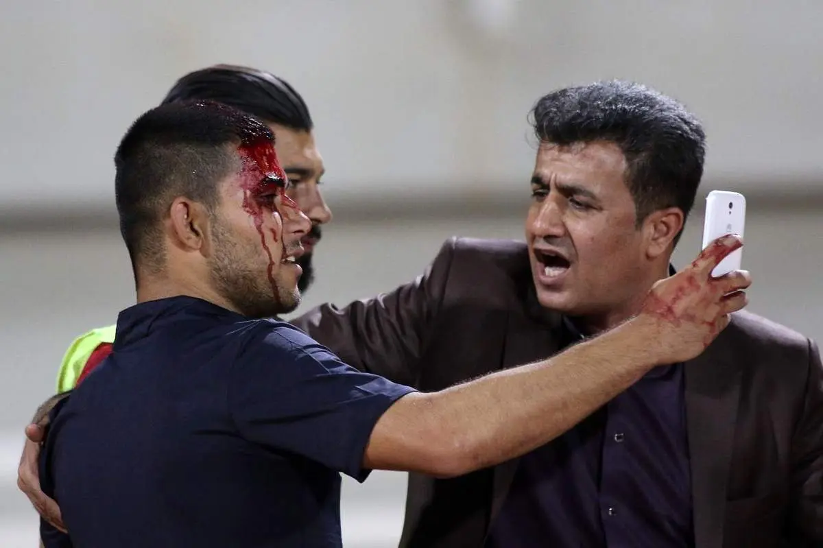 هواداری که سرش شکست اما سلفیاش را با رامین گرفت!