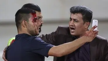 هواداری که سرش شکست اما سلفی‌اش را با رامین گرفت!