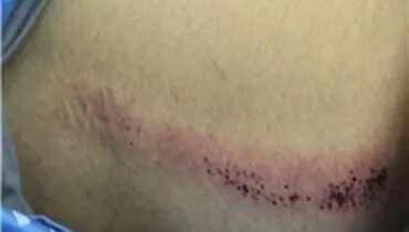 جزئیات ضرب و شتم دانش‌آموز تبریزی+عکس