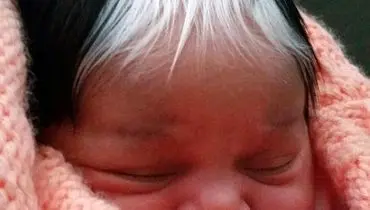 این نوزاد با موهای سفید بدنیا آمد +تصاویر